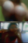 Naked girls injured
